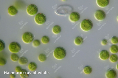 Observation d'algues unicellulaires d'eau douce au microscope